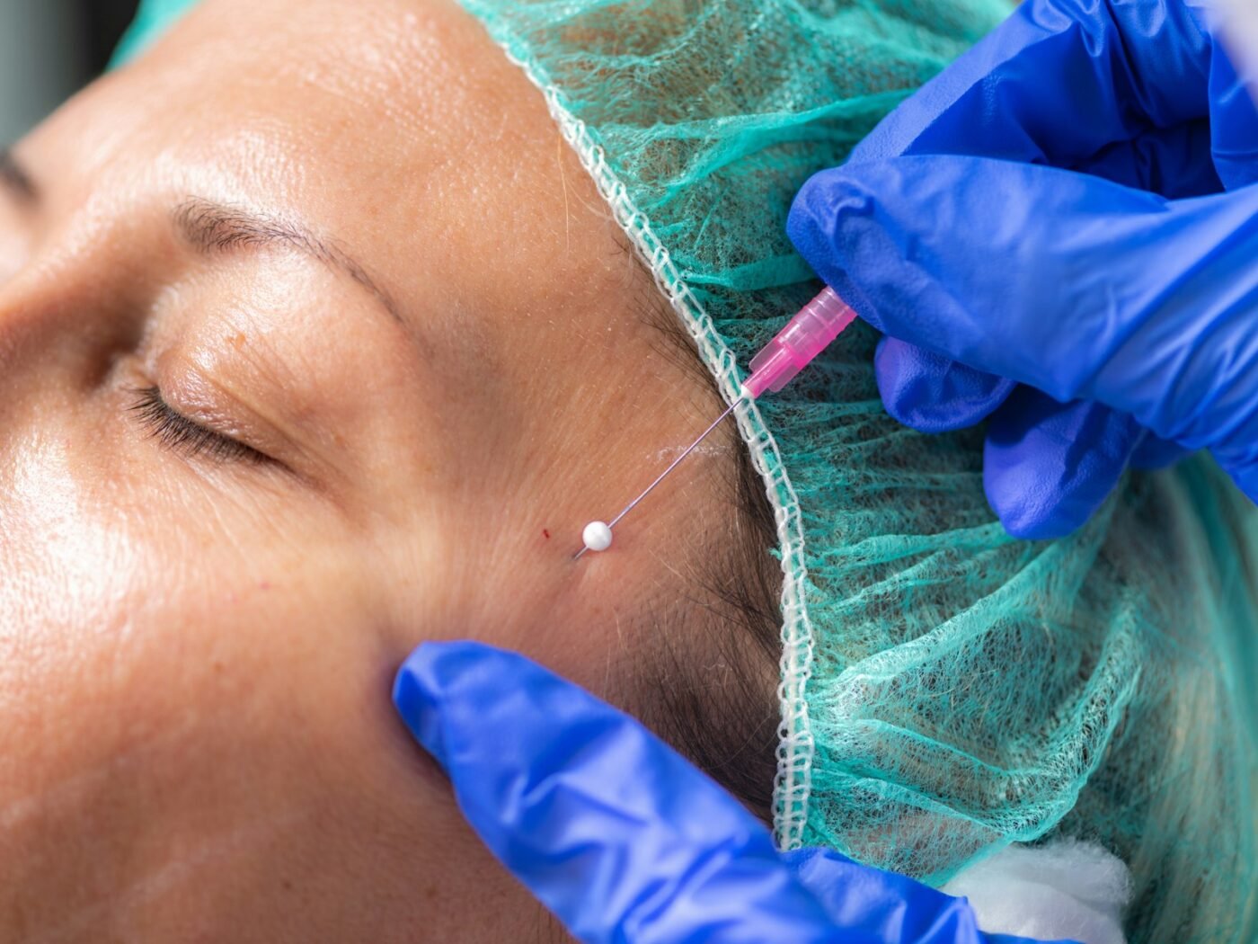 Botox, Fillers or Thread Lift? A Plain Guide to Non-Surgical Anti-Ageing