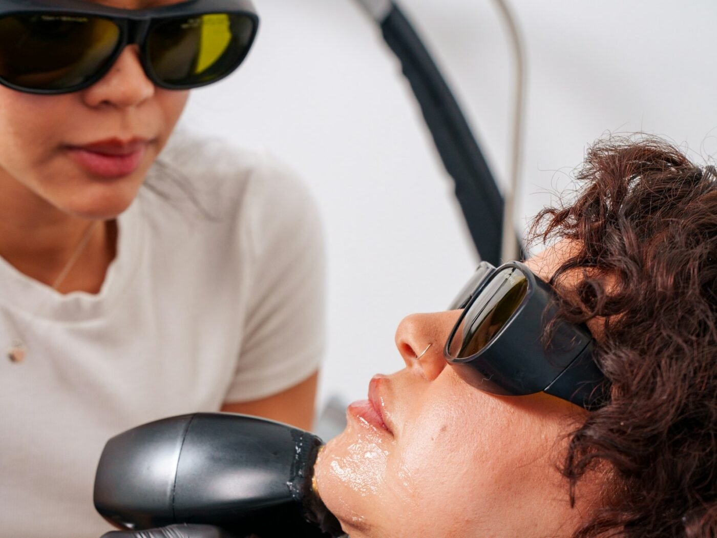 Skin Brightening Lasers